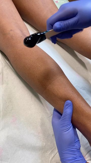 Waxing treatment